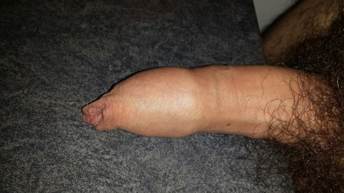 awesomeforeskin69: weerapaul: hairycock81:  My foreskin  Nice cock What I’d do to have a sniff