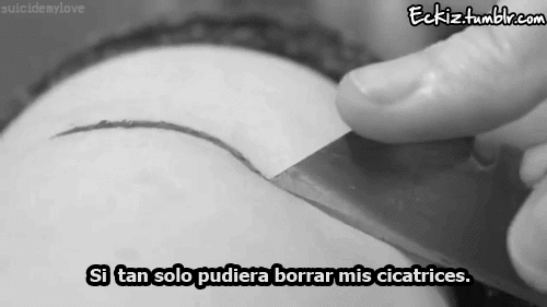 una-sonrisa-suicida:  No hay necesidad de crear cicatrices tampoco.