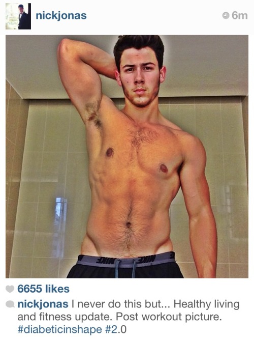 nickjonas