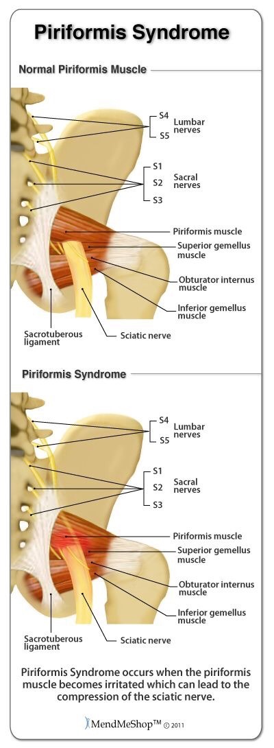 uaortho:  Random orthopaedic importanties 