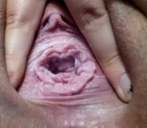 itwasloveatfistsite:  First one is, once again, a picture of my “resting gape” which is much, much, MUCH bigger than the last one I uploaded! And the other two are me fucking around :) I’m getting looser and sloppier every day and I feel like such