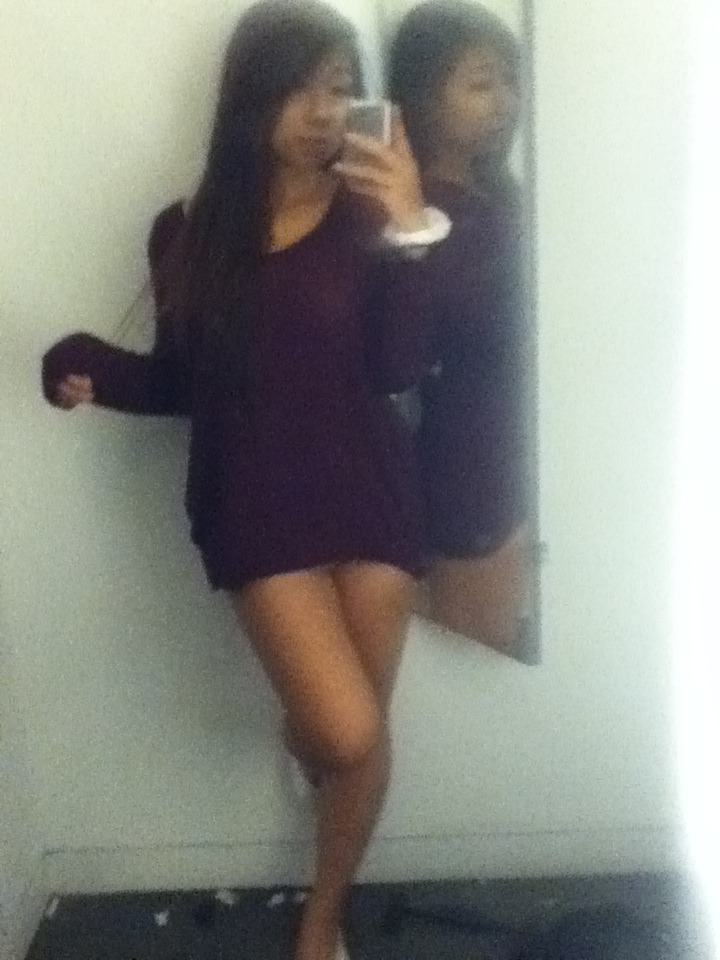 cindeetran:  my legs are starting to look better :o