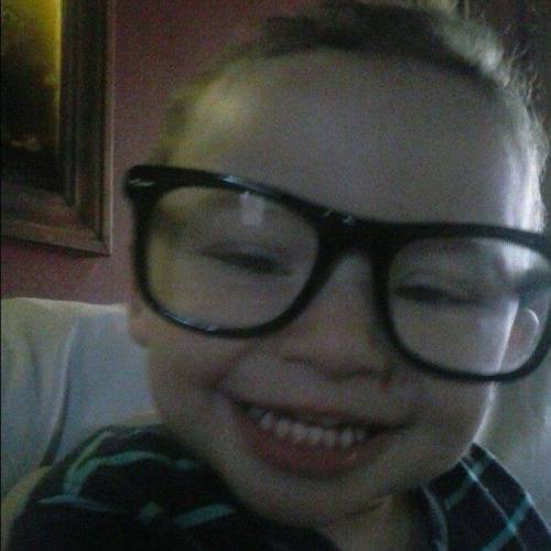 theskaldspeaks: anotherveganpunk: This kid here is Julian, he’s 2 years old now. He was tragic
