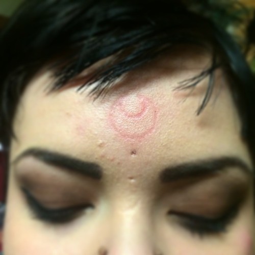 thebeaucheneskull: Sailor moon #solarbrand about 3 weeks into healing #solarbranding #solaradornment