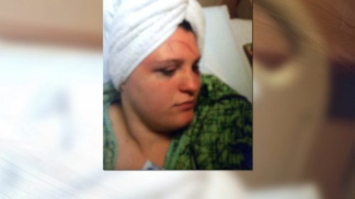allinternationalnews: A pregnant teenager was brutally beaten by two customers while on the job this