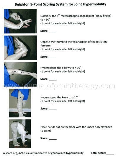 uaortho:  Random orthopaedic importanties 
