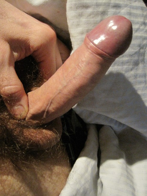 Beardburnme