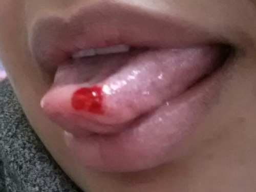 mysterygirl21:  Ow ow ow! I bit my tounge!