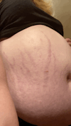 mrbagel:feedqueenisabel:Ready to pop🥵3 days later…So. Fucking. Flabby. Love…!