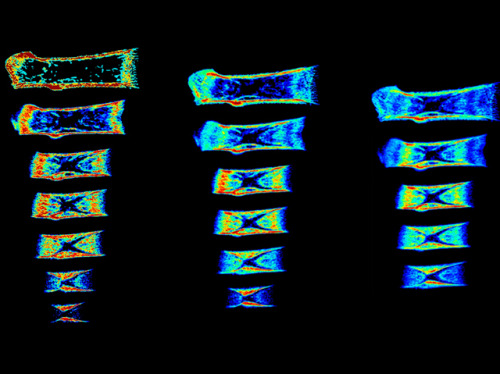 bpod-mrc:  Growing Planes    Our bones grow from points called growth plates, which are located on each end of bones, just below our joints. Specialised cells produce cartilage on one side of the growth plate that becomes calcified and pushes the end