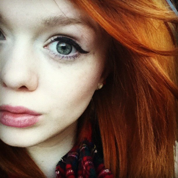  Lass and her freckles &lt;3 