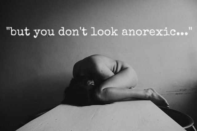 skinnedkneesbrokenbones:  So far away from being perfect…
