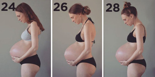 sixpenceee:Three Kids Growing in One Belly This is Maria, 36 of Copenhagen, Denmark. Her husband a