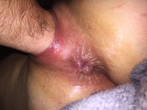 strechingisfun:  strechingisfun:  My pussy being well used!! Fisted, Fingered and Stretched. She is so red and swollen! Yes I love my pussy being abused