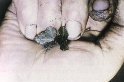 congenitaldisease:A cadaveric spasm is the instant muscular stiffening that can occur at the very moment of death. This victim grasped at vegetation before falling into water.