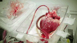 sixpenceee:  In an organ transplant surgery, timing is critical. Doctors drop organs into a plastic bag and put them on ice. But lungs soon stop breathing. Hearts stop beating. The organs essentially shut down and start to deteriorate. This means doctors
