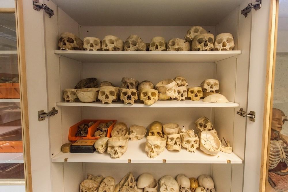 flyonthewallmedstudent:  forensicimagination:  (via What Happens When You Donate