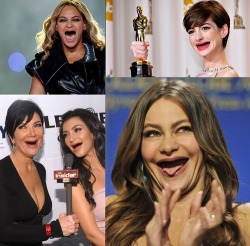 hurpthederp:  angelcasimiro:   Celebrities without teeth.   im cRYING