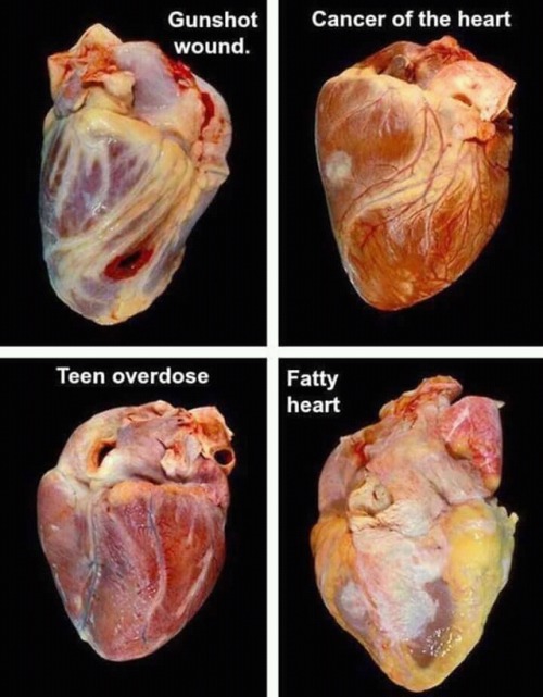 Cardiology / Cardiología