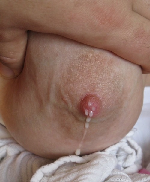 preggosarehotties:  A quickie of some swollen breasts full of milk, because I love big fat nipples and milk!