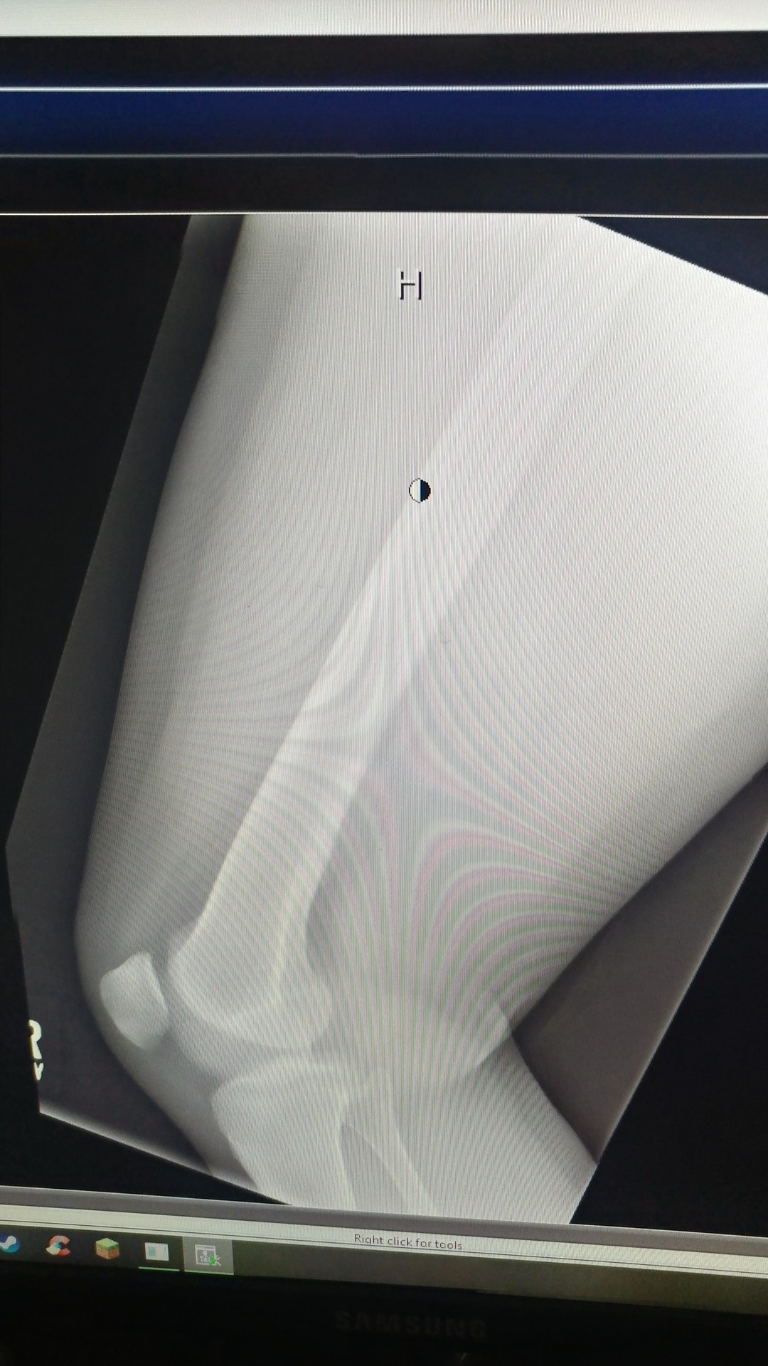 Here&rsquo;s my bones it doesn&rsquo;t look like I have cancer but I&rsquo;m