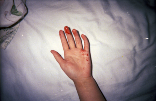 Bloody by Cassandrea Xavier Via Flickr: Shot on a disposable film camera