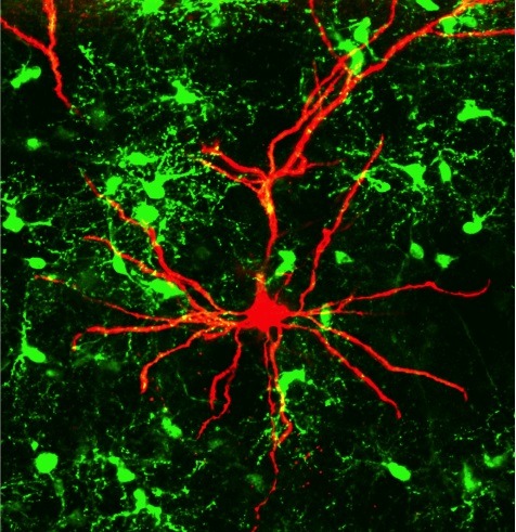 neurosciencestuff:  (Image caption: Oligodendrocyte progenitor cells in the brain