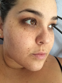 bigcutieboberry:  Freckle face. 