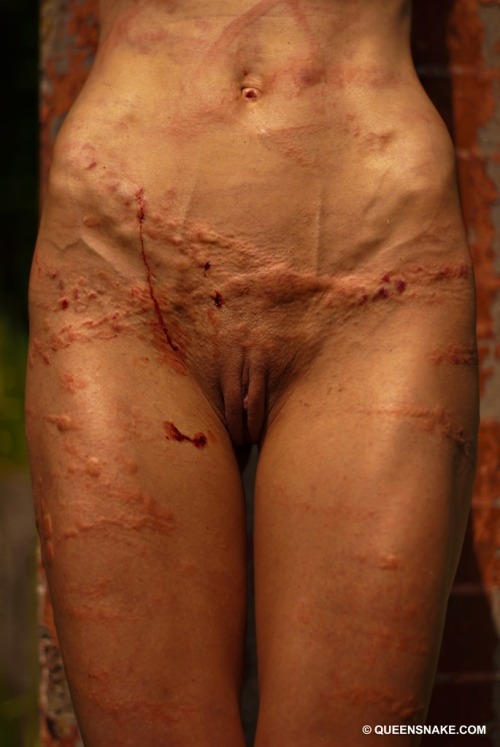 ilovepornextreme:  Battered and Beaten