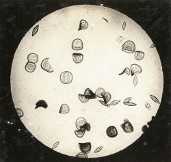 dame-de-pique:  Arno Vater, 1931  Diatomaceous earth Cestoda, cross-section Calcareous sponge   Cretaceous period sea animals 