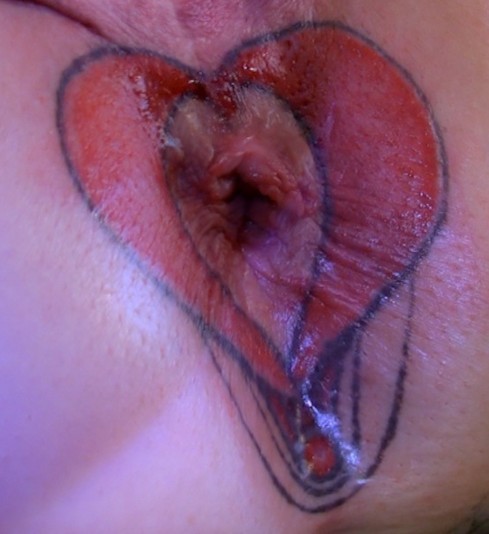 bundalovv:  Tattoo turning a female anus into a “brown vagina”.