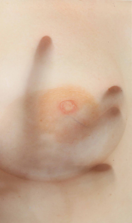 aurasandseizures:ALIX MARIE | Mammography, 2015 80 x 60 cm with frame Epson gloss paper Courtesy of 