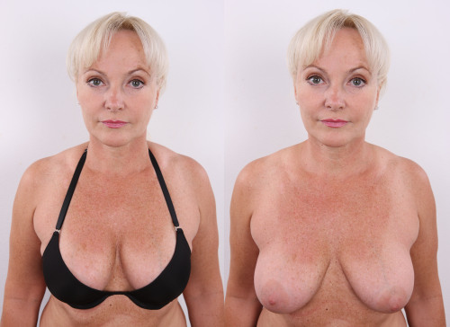 BNBDb - Big Natural Breasts Database
