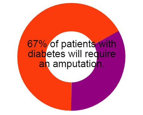 #100days Day 038
67% of patients with diabetes will require an amputation of some kind. This may be a toe, a foot, a hand, or even something more drastic. Prevention and early detection of nerve damage are key to preventing the need for...