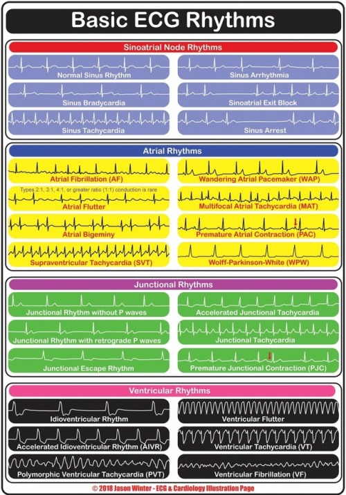 thecodethreechronicals: Who else sucks at cardiology? ‍♀️ I promise the more you look at these t