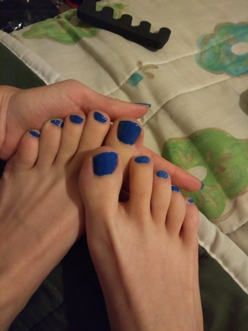 75poison-feet: so team Paint Your Nails won this time someone told me people with issues like blue 