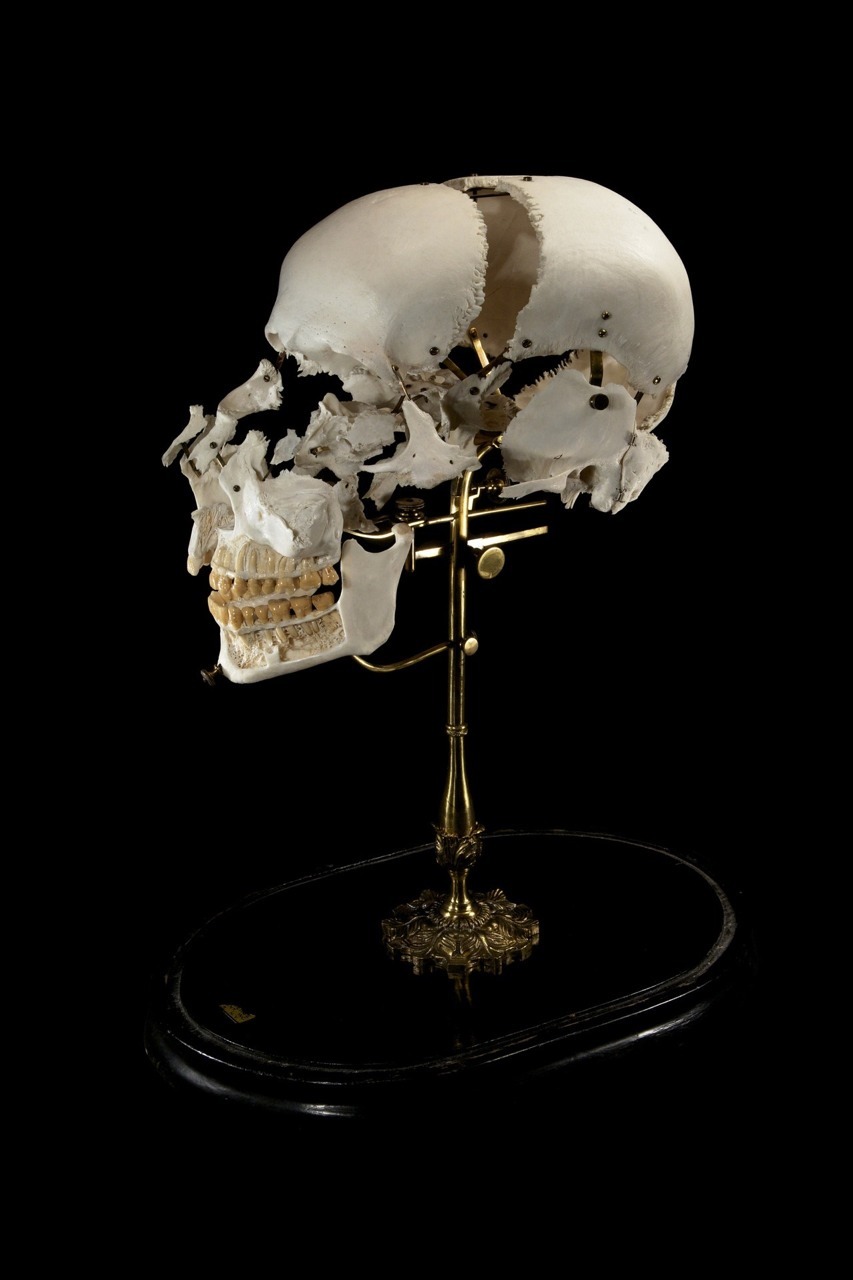 jack089:  Exploded and dissected skulls. Beauchene Skull - Mounted preparation of