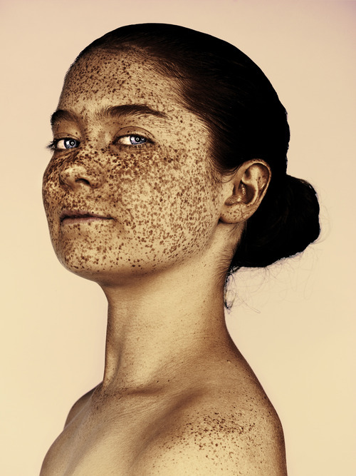 Porn photo burnagain:  soldsoulglenx:  Amazing Freckles