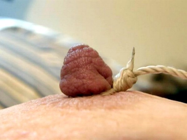 All nipples