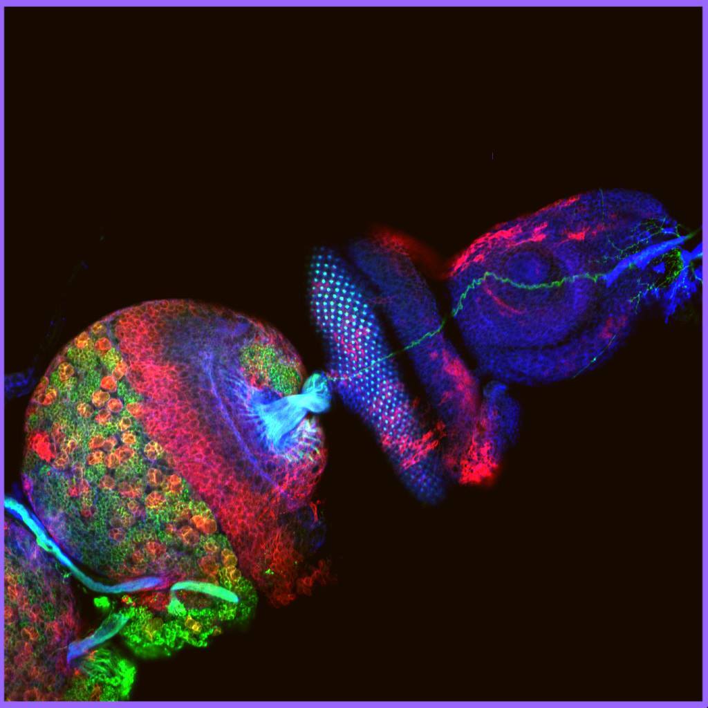 talesofscienceandlove:  from Molecular Probes Top: Central brain hemisphere and