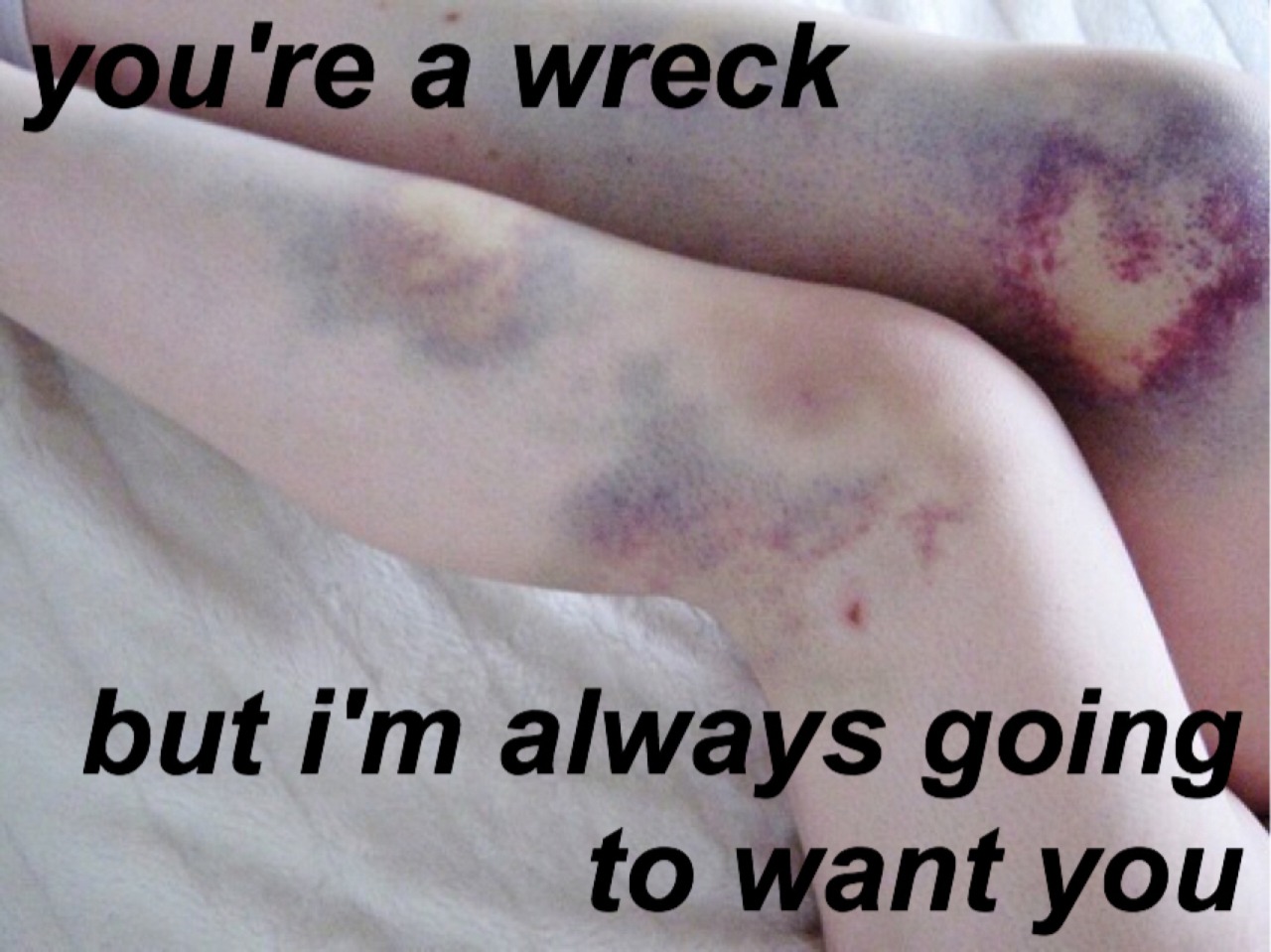 mickeyyrafckup:  creek blues // nicole dollangangersources of pics: x xplain bg