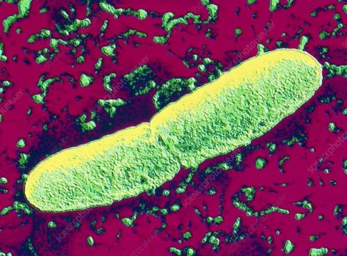 Above is an image of the Yersinia pestis bacterium. This little bacterium, which coincidentally look