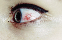 sittenlos:  my poor eye by Angela Grubich  
