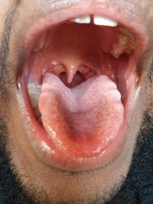 smuggular: Here’s just a little bit of me showing off my mouth