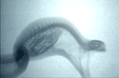 brainsx:  X-ray of a snake swallowing an egg 