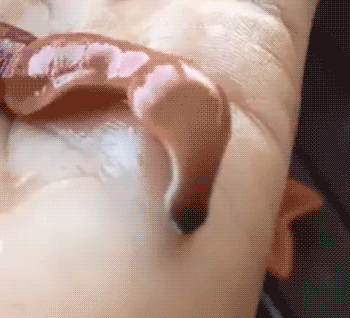 congenitaldisease:   The ribbon worm can shoot a web like substance which is used to catch prey that