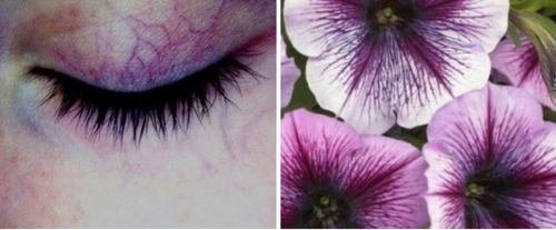 poi-scappiamo:  Body comparative Iris: blooming-buds