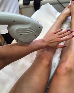 Full body hair laser removal… Getting