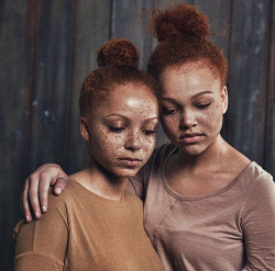 naturalhairqueens:  Freckled beauties! 