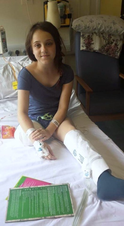 unusualpassions:  Suffered from Neurofibromatosis Type I which left her right leg swollen and covere